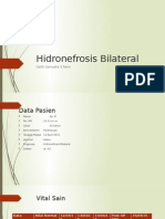 Hidronefrosis Bilateral