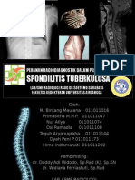 Spondilitis TB