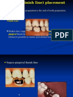 Finish Line of The Preparation Is The End of Tooth Preparation