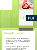 Stomatita.pptx