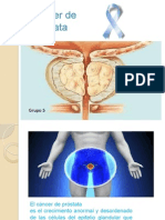 Cancer de Prostata