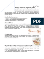 Arrangement of Posterior Artificial Teeth