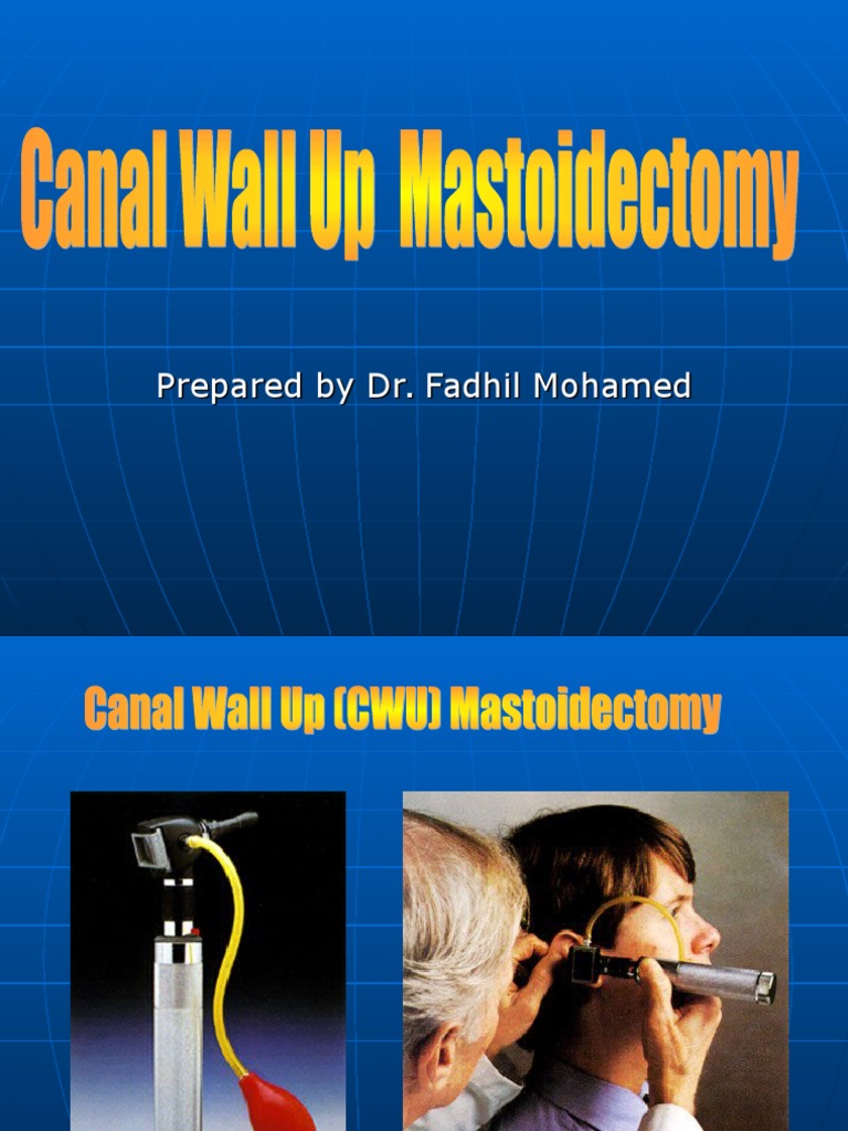 Wall Up Mastoidectomy Overview | PDF | Surgery | Human Anatomy