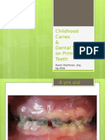 Childhood Caries & Dental Trauma On Primary Teeth: Henri Hartman, Drg. SP - KGA