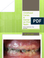 Early Childhood Caries and Dental Trauma on Primary Teeth