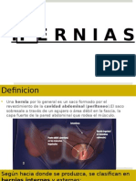 Hernias Inguinales