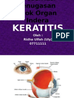 Keratitis