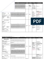 Dysrhythmias Chart