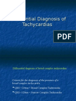 Differential Diagnosis of Tachycardias