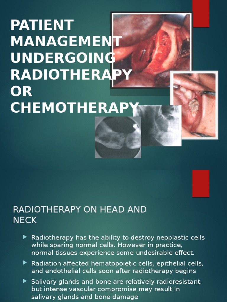 Dental Management of The Patient Undergoing Radiotherapy or Chemoterapy