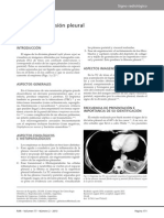 Division Pleural