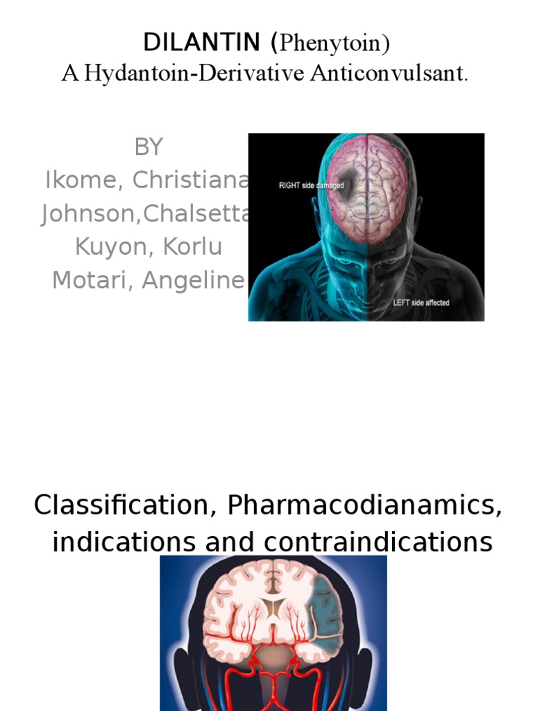 Dilantin 360 Mg