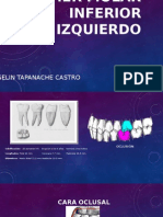 Primer Molar Inferior Izquierdo