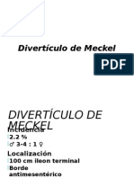 Diverticulo de Meckel