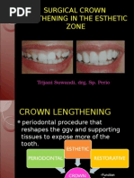 Download Surgical Crown Lengthening by Jevin Stivie Cialy SN263729352 doc pdf