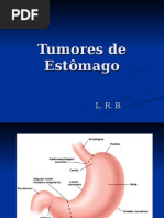 CA Gastrico - Aula 4ano