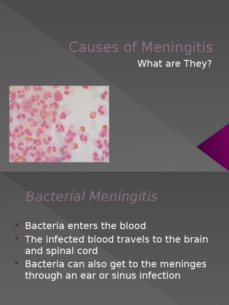 Causes of Meningitis What Are They? PDF
