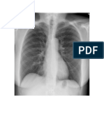 Examen Radiologia Torax