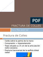 Fractura de Colles