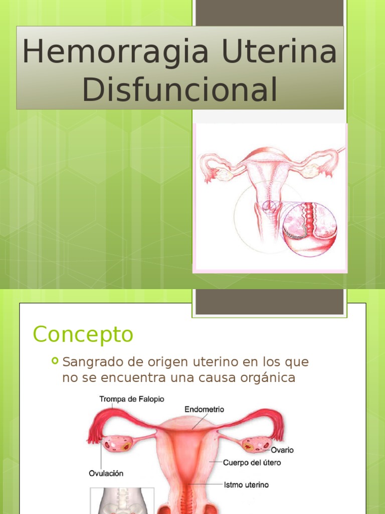 Hemorragia Uterina Disfuncional