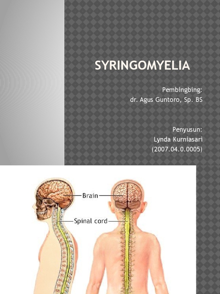 Panduan Syringomyelia | PDF | Sains & Matematika