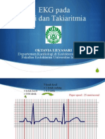 1c Dr. Vivi - Ekg Aritmia