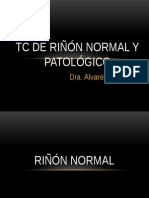 TC de Riñón Normal y Patológico
