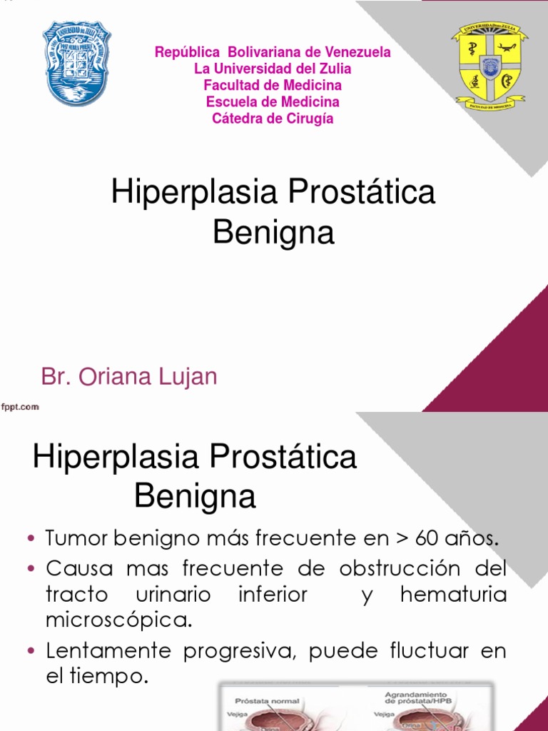 hiperplazia benigna de prostata diagnostic)