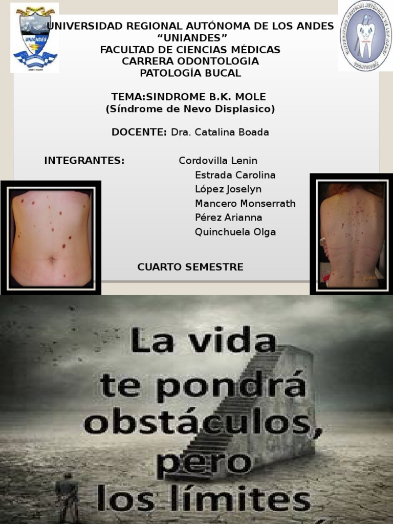 Sindrome de Nevo Displasico | PDF | Melanoma | Piel, image size:768x1024