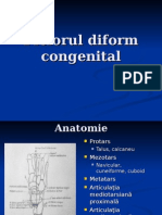 Piciorul Diform Congenital