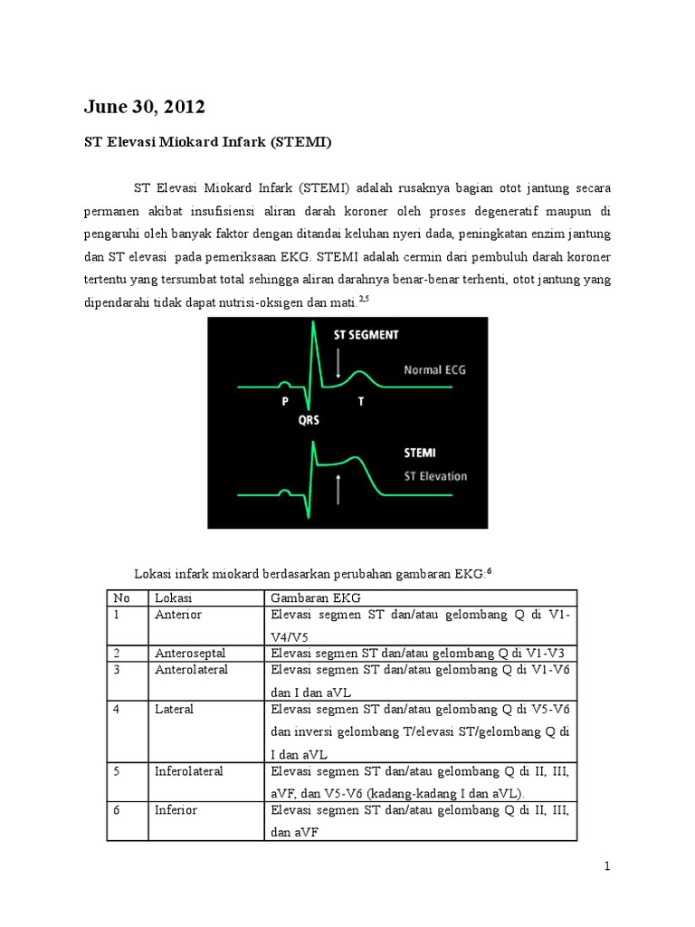Stemi | PDF