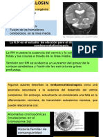 Romboencefalosinaps