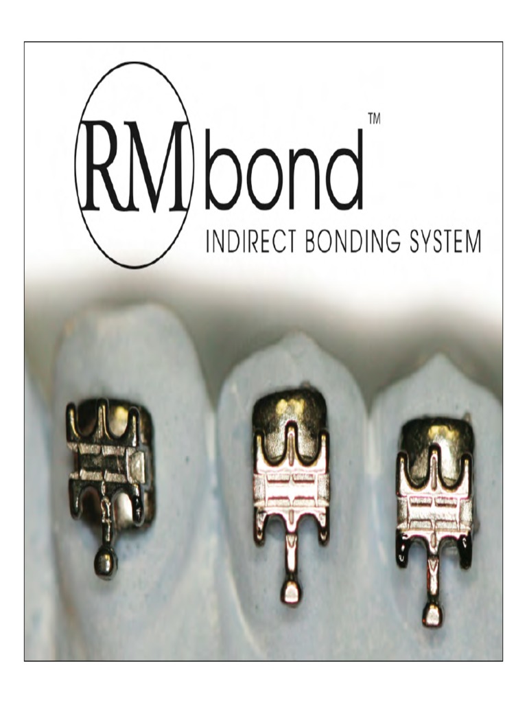 Indirect Bracket Bonding Orthodontic IDB LAB Bonding Lab Set Up PDF Dental Composite Mouth