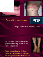 Vasculitis de Vasos Medianos - Jorge Fernando Cassanova