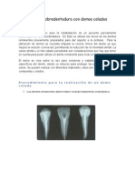 Protocolo de Sobredentadura Con Domos Colados