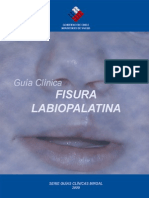 Fisura labiopalatina