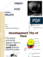 Development OF Face, Nose AND Palate