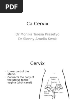 Ca Cervix: DR Monika Teresa Prasetyo DR Sienny Amelia Kwok