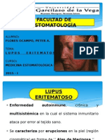 Lupus Eritematoso ( Expo )