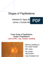 Stages of Papilledema Digre
