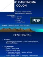 Adeno Carcinoma Colon