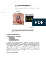 Electrocardiogram A