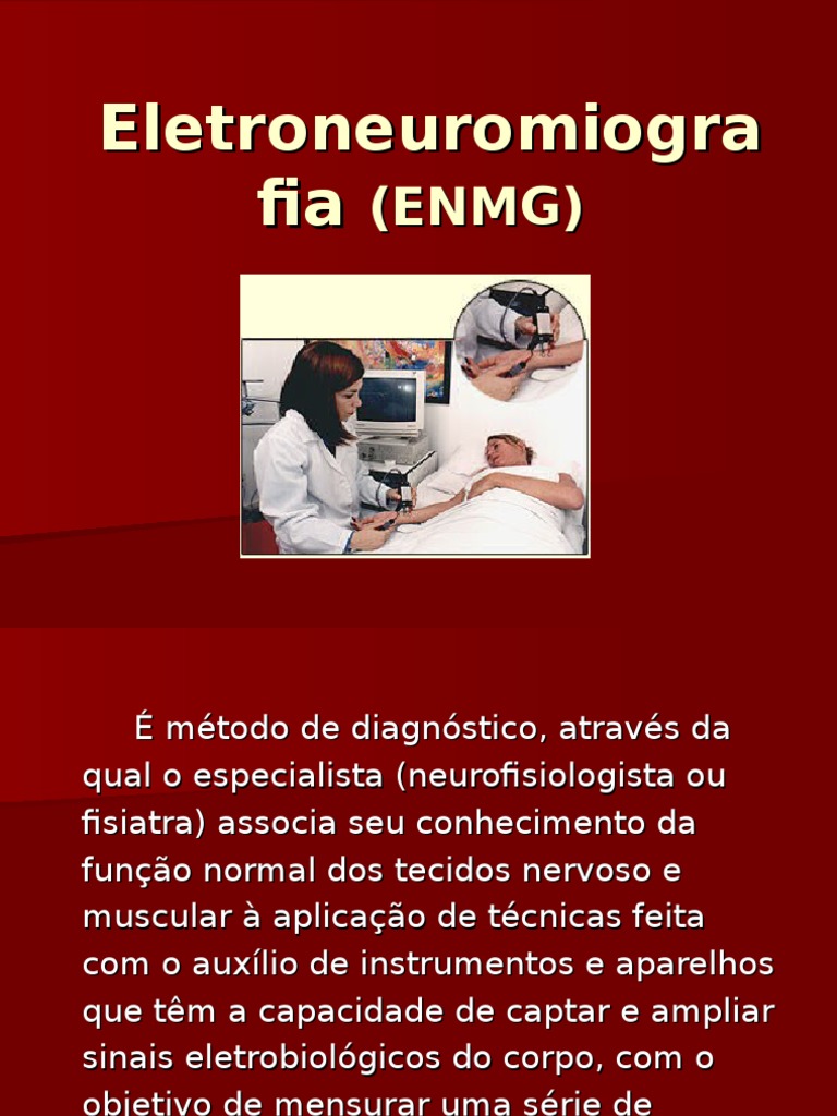 Entendendo a Eletroneuromiografia | PDF | Nervo | Eletromiografia