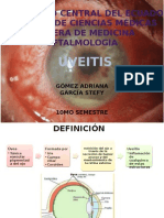 Uveítis: causas, clasificación, síntomas y diagnóstico