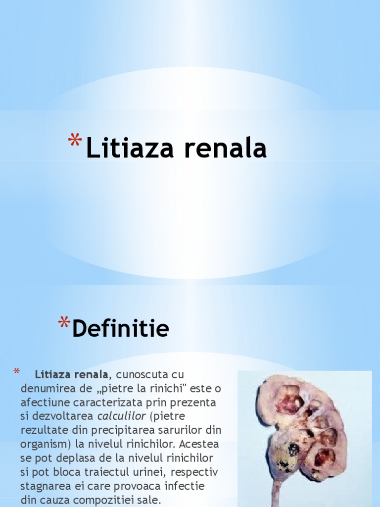 Litiaza Renala | PDF