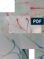 Eosin staining