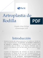 Artroplastia de Rodilla