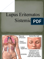 Lupus Eritematos Sistemic
