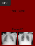 Download radiologi Thorax Normal by Tiradewi Bustami SN265252711 doc pdf