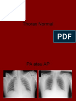 Radiologi Thorax Normal